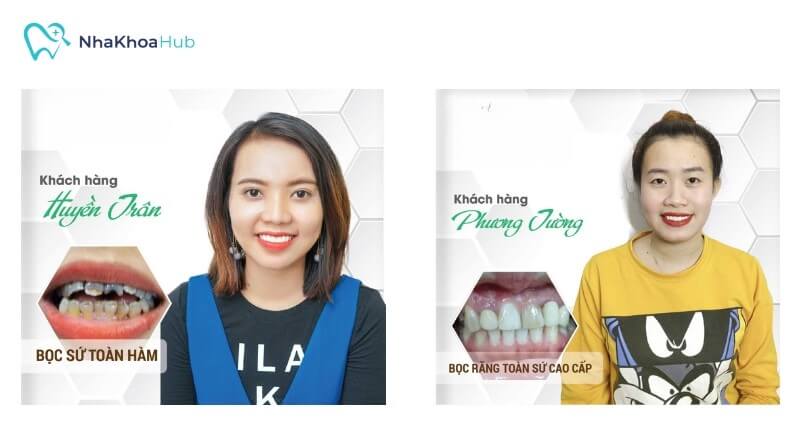 Khách hàng về Nha khoa Hải Âu Khách hàng về Nha khoa Hải Âu