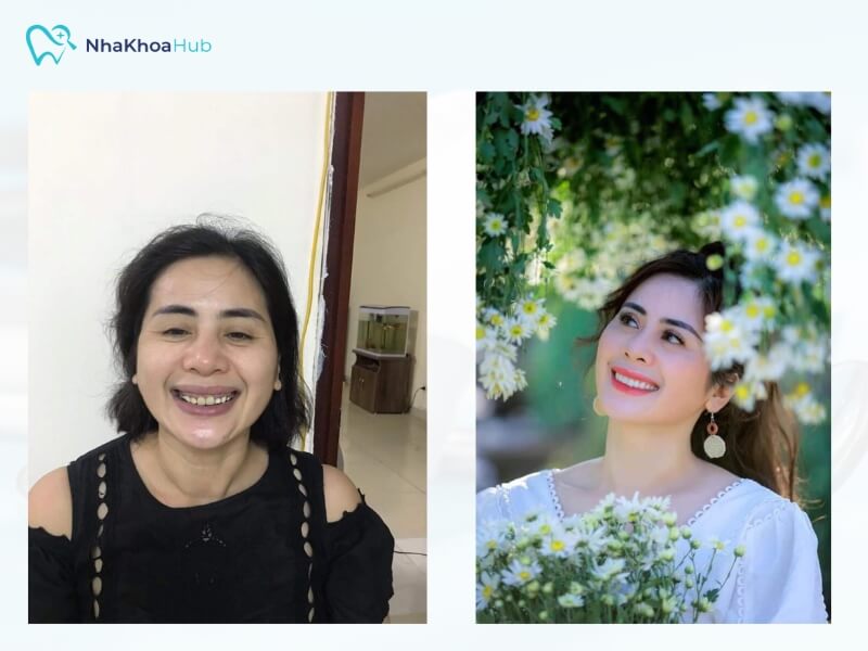 Feedback của khách hàng tại Nha Khoa Quốc Tế New.Smile