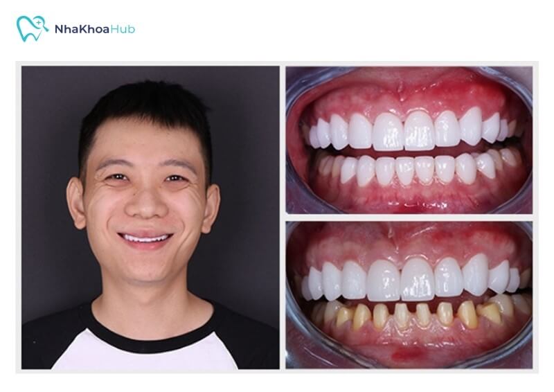 Hình ảnh khách hàng tại Nha khoa Thái Linh