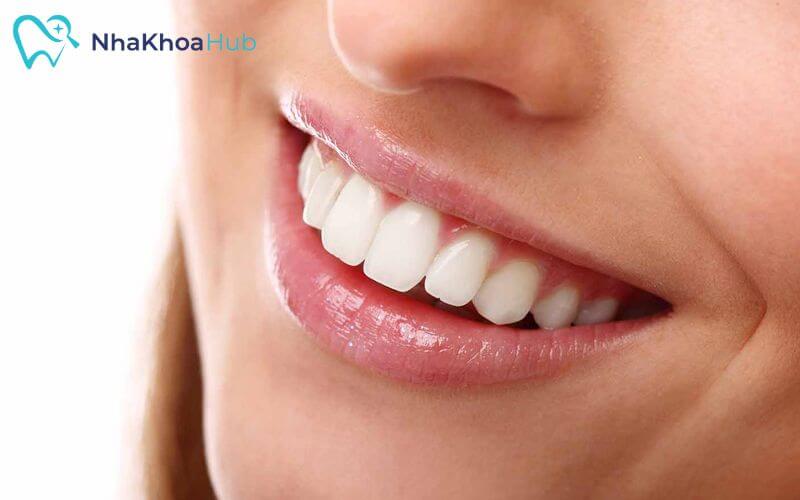 Mức giá làm răng thẩm mỹ tại Smile Care khá hợp lý