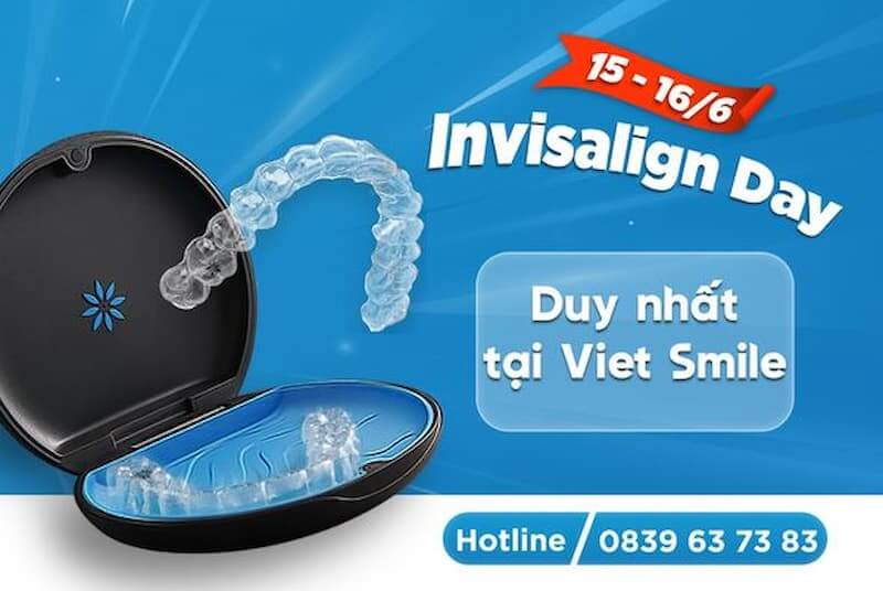 Nha khoa Việt Smile cùng hàng ngàn quà tặng hấp dẫn