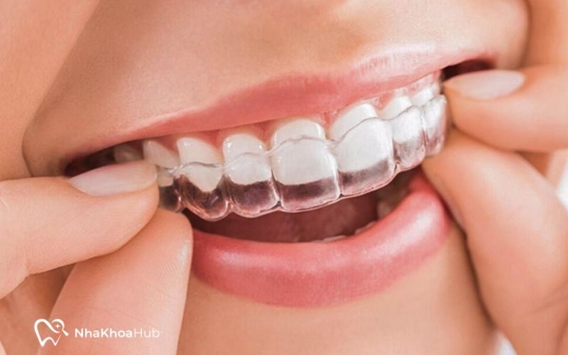 Các dịch vụ tại nha khoa Dr. Vương Các dịch vụ tại nha khoa Dr. Vương