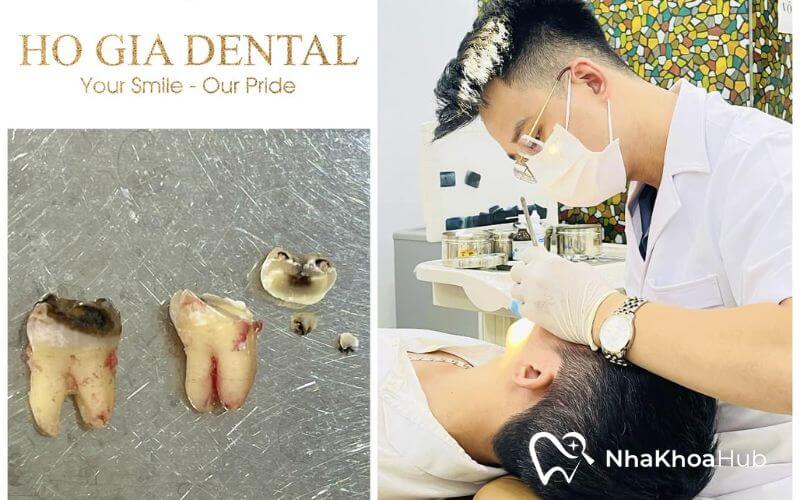 Những dịch vụ nha khoa nổi bật tại Hồ Gia