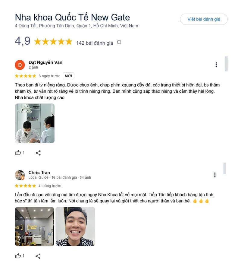 Không chỉ niềng răng, dịch vụ nha khoa tổng quát đều gây ấn tượng với người dùng