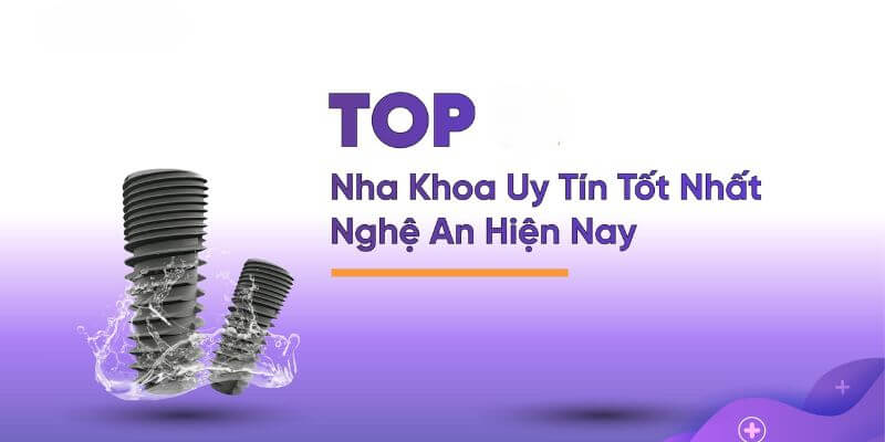 Thông tin về nha khoa uy tín tại Nghệ An