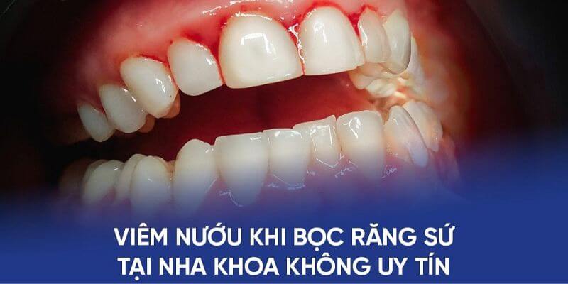Nha khoa kém chất lượng gây ra hệ lụy đáng tiếc