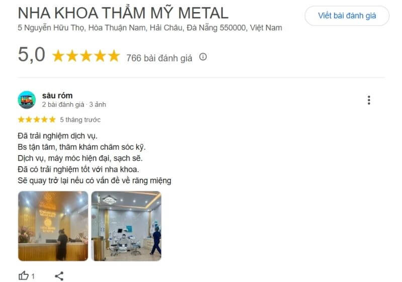 Đơn vị ứng dụng công nghệ hiện đại gồm CT Cone Beam, máy scan Itero 5D, siêu âm Piezotome, đảm bảo điều trị an toàn và chính xác.