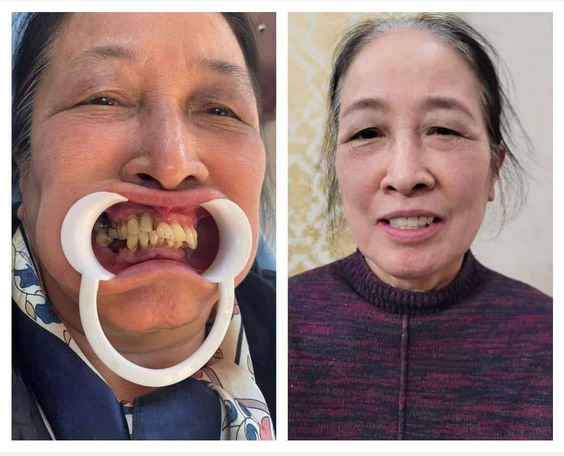 Quang Dũng cung cấp nhiều dịch vụ nha khoa