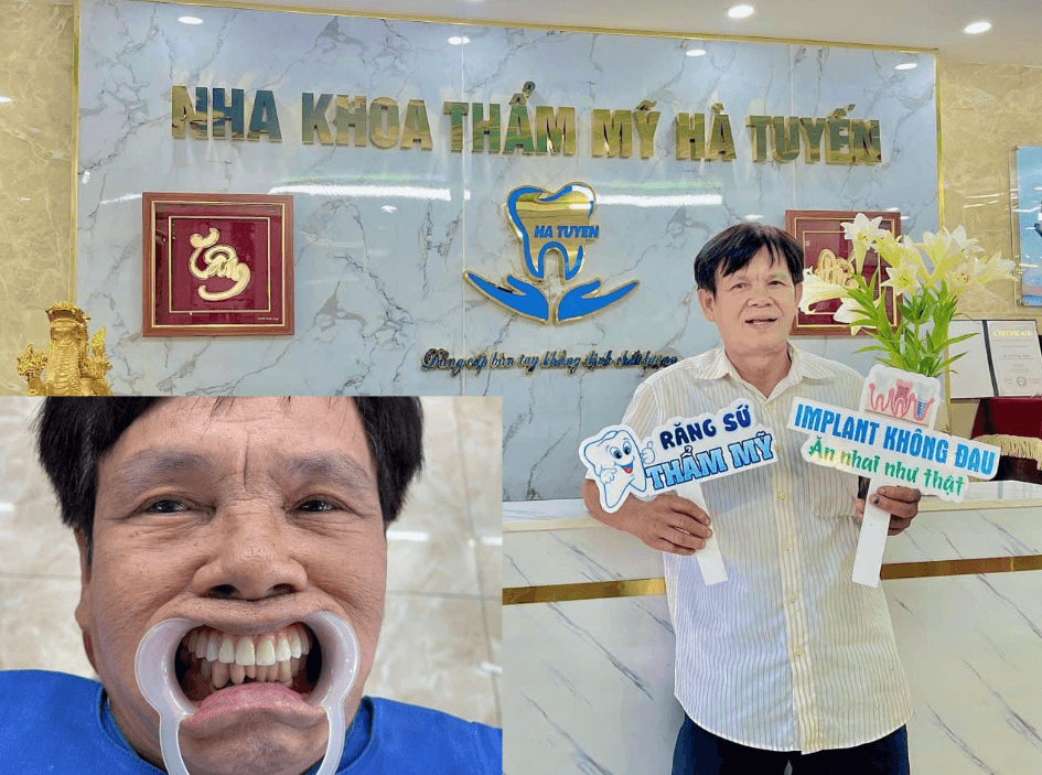 Chú Trần Văn Hùng trồng răng tại Hà Tuyến