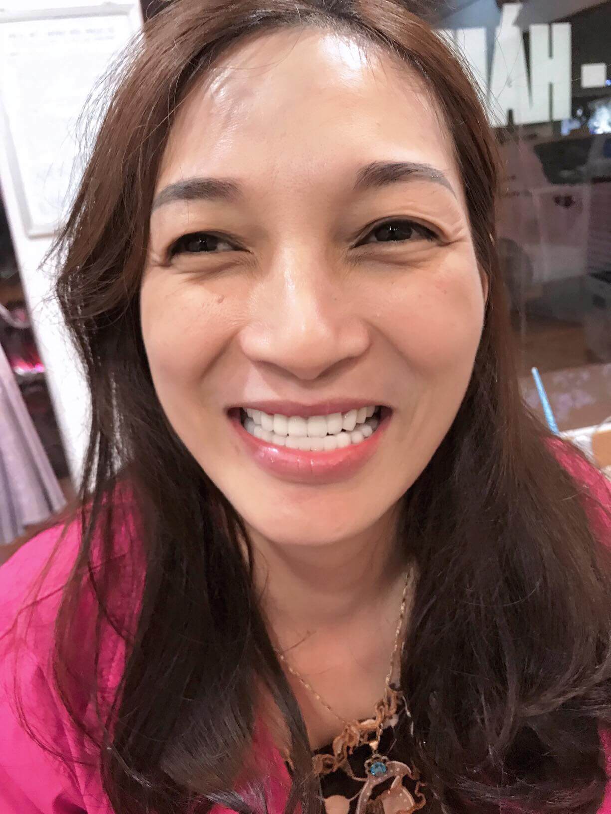 Cô Hoàn review dịch vụ bọc răng sứ ở Đại Anh