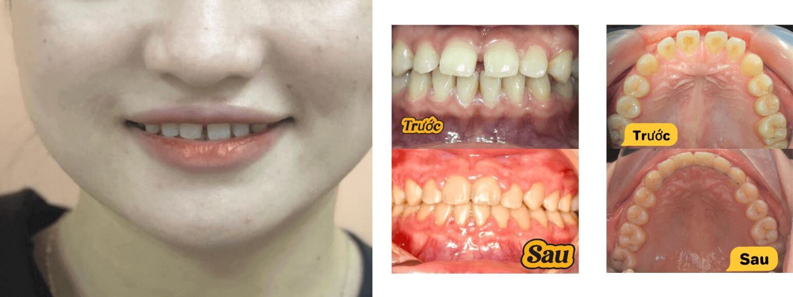 Một trong những ca thành công tiêu biểu là khách hàng Trịnh Minh Anh