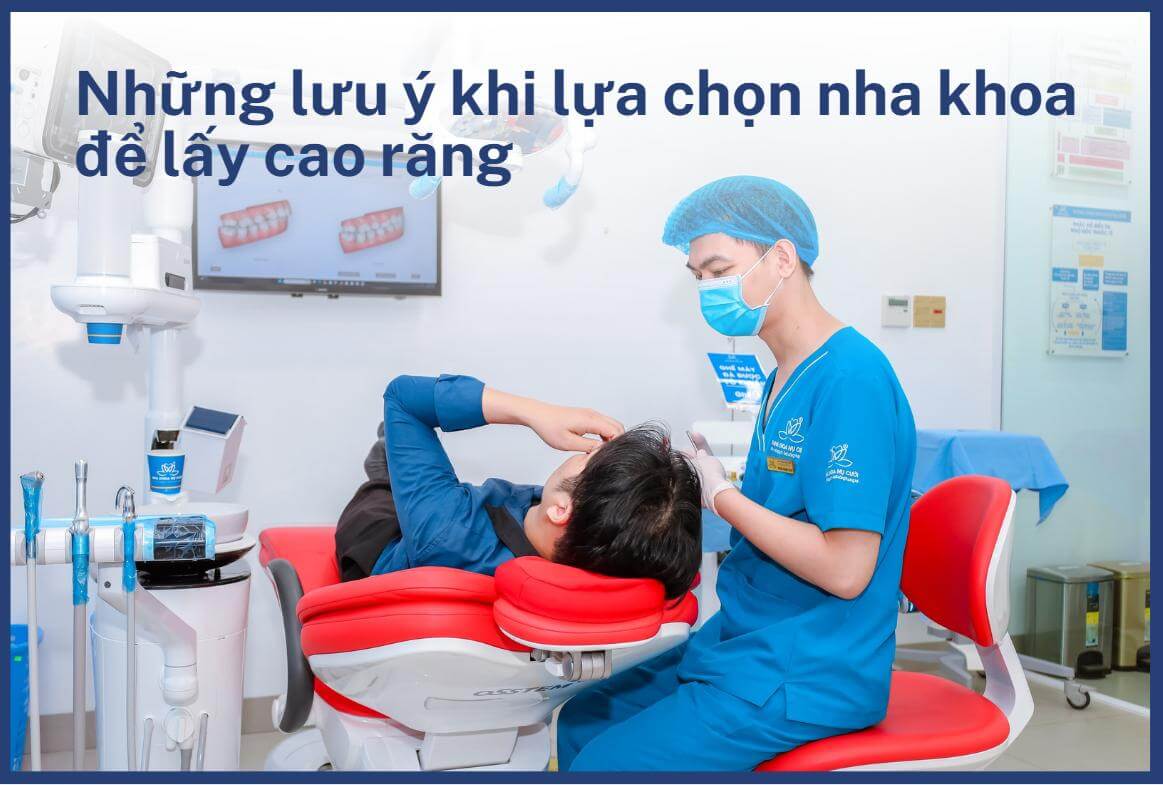 Các yếu tố cần lưu ý khi lấy cao răng